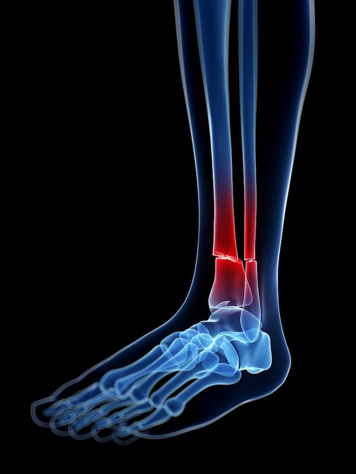 Kiné traumatologique et orthopedique